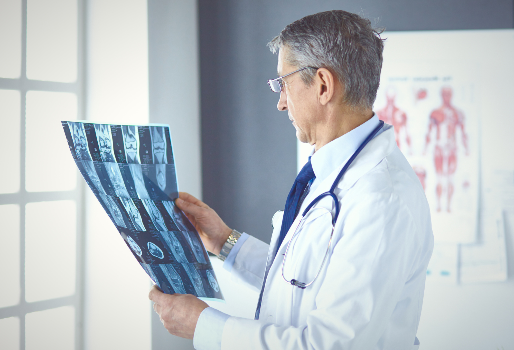 Radiolog undersøker en pasients røngtenbilder